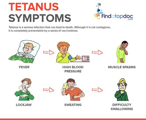 Tetanus Symptoms Photograph By Findatopdoc Pixels