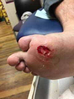 Foot definition, (in vertebrates) the terminal part of the leg, below the ankle joint, on which the a unit of length, originally derived from the length of the human foot. foot ulcer - The Tampa Podiatrist