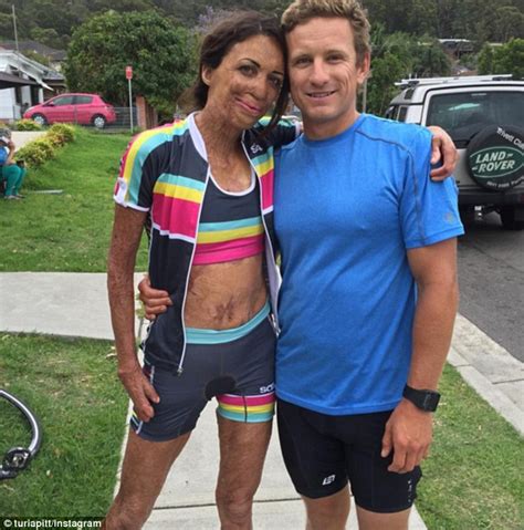 Turia Pitt To Complete Ironman Triathlon Years After Suffering Burns In Bushfire Daily Mail