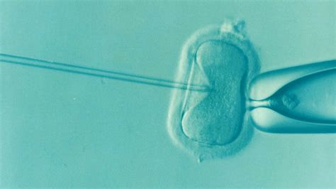 What You Should Know About Ivf Procedure Vancouver Fertility Clinic