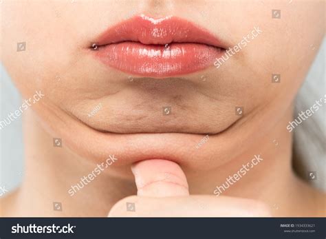Woman Who Pinches Fat On Her Stock Photo Shutterstock