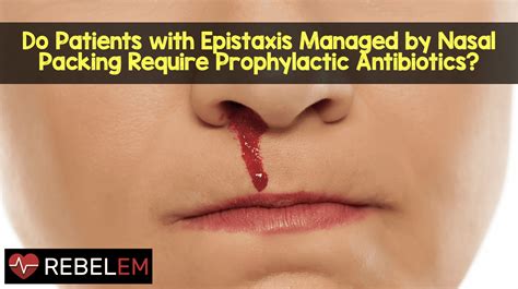 Do Patients With Epistaxis Managed By Nasal Packing Require
