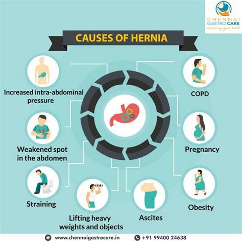 Hiatal Hernia Symptoms 5 Hiatal Hernia Natural Remedies In 2021