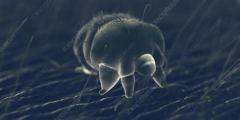 Scabies Mite On Human Skin Illustration Stock Image F