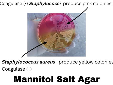 Mannitol Salt Agar Msa Rbr Life Science