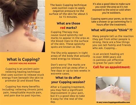 Learn Cupping For Healers