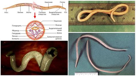 Roundworm Structure