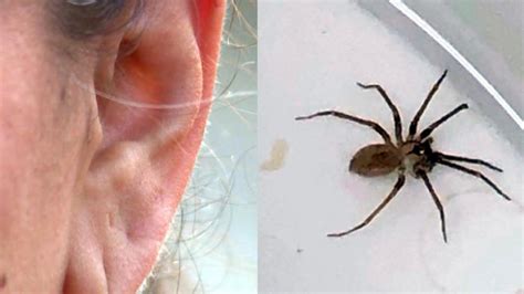 highly venomous brown recluse spider   womans ear wavycom