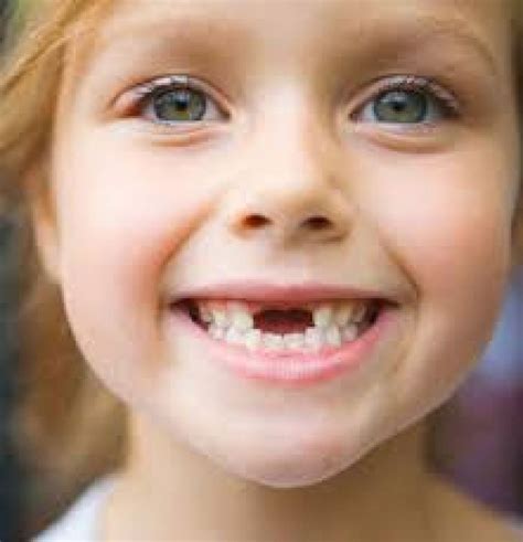 Loss Of First Baby Tooth A Positive Experience For Children Cuba Si