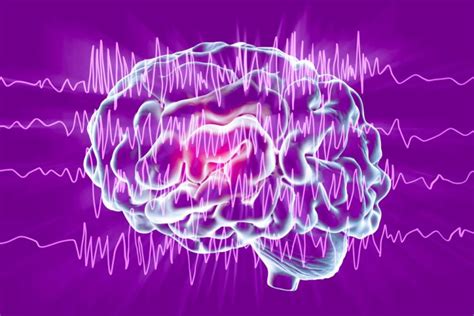 Epilepsy Rescue Therapy Significantly Increases Time Between Seizure Clusters
