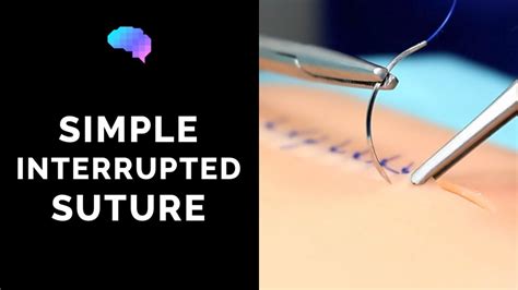 Mastering Surgical Suturing Techniques A Comprehensive Guide Best