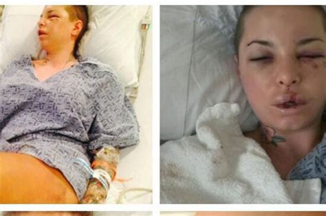 Broken Christy Mack Issues Full Statement Graphic Photos In Wake Of Alleged Savage Assault From