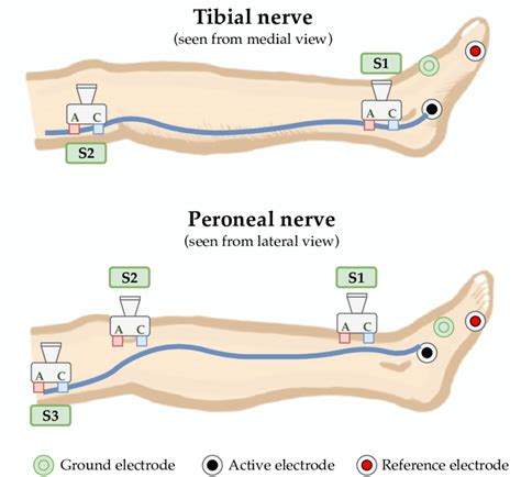 Electroneuronography Of The Peroneal And Tibial Nerves And The Various Download Scientific