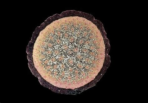 Light Micrograph Lm A Transverse Section Of A Stem Of A