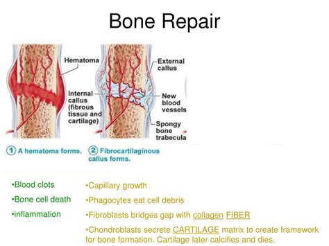 What Are The 4 Steps Of Bone Healing Best Home Design Ideas