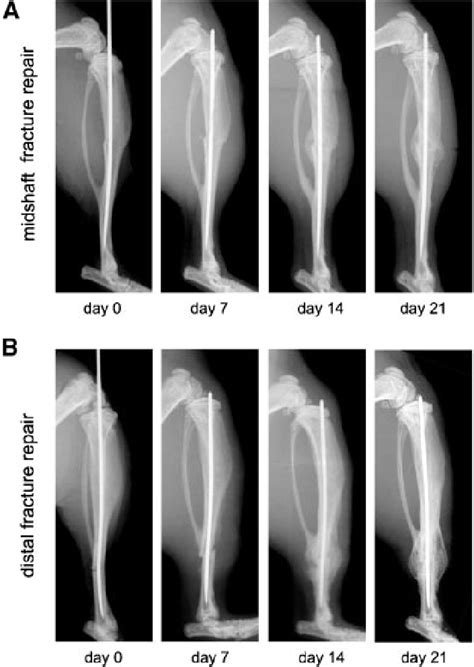 Progression Of Repair In Tibial Fracture Models A In The Tibial