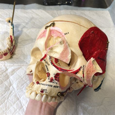 Raffle For Real Human Skull Oddarticulations Llc