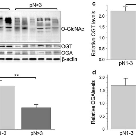 Alteration Of O Glc Nac Modified Proteins Ogt And Oga Levels In Idcs