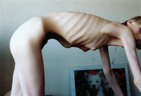 Anorexia Video Naked Sex Porno Photo