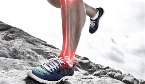 Medial Tibial Stress Syndrome Mtss Cause Symptoms Treatment