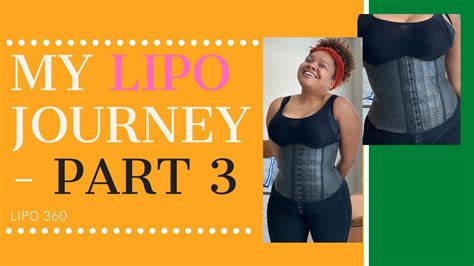 My Liposuction Journey Lipo 360 Part 3 How Much Was It Youtube
