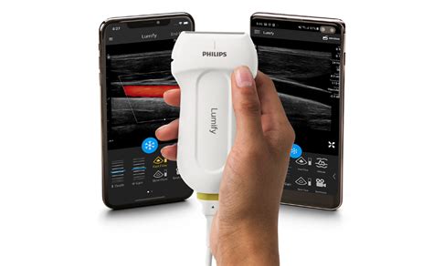 Philips Facilita La Evaluación Del Flujo Sanguíneo En Tiempo Real Con