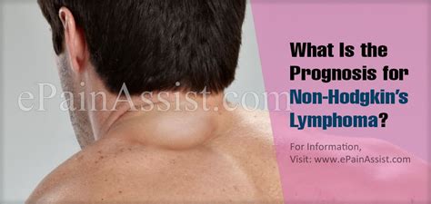 What Is The Prognosis For Non Hodgkins Lymphoma