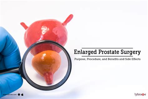 Enlarged Prostate Surgery Purpose Procedure Benefits And Side Effects