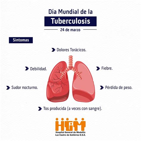 Sint Tico Foto Dia Mundial De La Tuberculosis Infografia Lleno