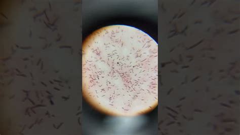 Lactobacillus Bacteria Under Microscope Bacteria In Curd Youtube