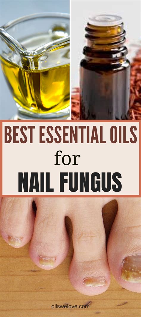 What Are The Best Essential Oils For Nail Fungus Nail Fungus Best