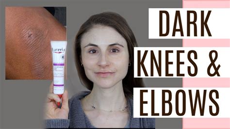 Fade Dark Elbows And Knees Qanda With Dermatologist Dr Dray