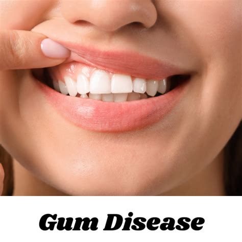 Gum Disease Treatment Freedom Dental