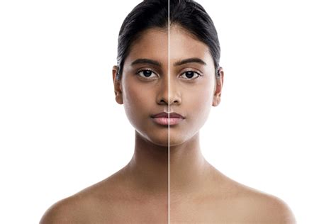 Skin Lightening Products Can Cause Permanent Damage But Users May Not