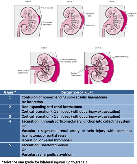 Grade Iv Renal Trauma Management A Revision Of The Aast Renal Injury