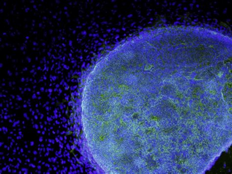 Microscopy Is Giving Us Insight Into The Secret Lives Of Cells The