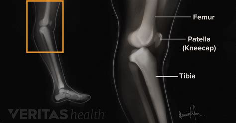 Knee Cap Xray Cheaper Than Retail Price Buy Clothing Accessories And Lifestyle Products For