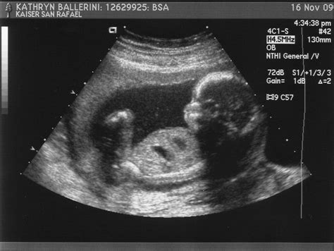 Danny, Katie, baby Danny and Jimmy Bear!: IT'S A BOY-19 ...