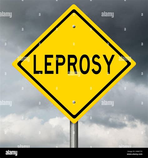Rendered Highway Sign Warning About Disease Stock Photo Alamy