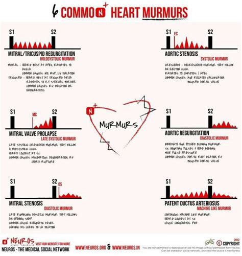 What Is A Heart Murmur What Are Some Common Reasons That Heart Murmurs