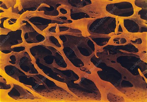 Spongy Bone Tissue Coloured Sem Stock Image P1050196 Science