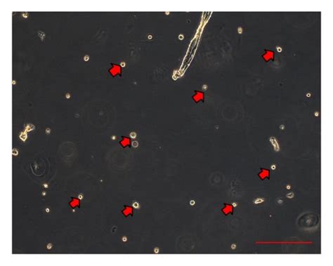 Sphere Formation Assay On Osa3 Cscs After 24 H From The Start Of The