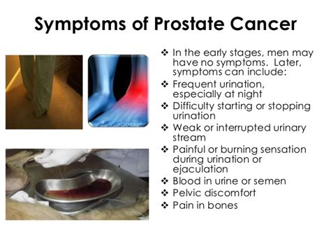 Symptoms Of Prostate Cancer In Men Should Not Be Ignored All To Health