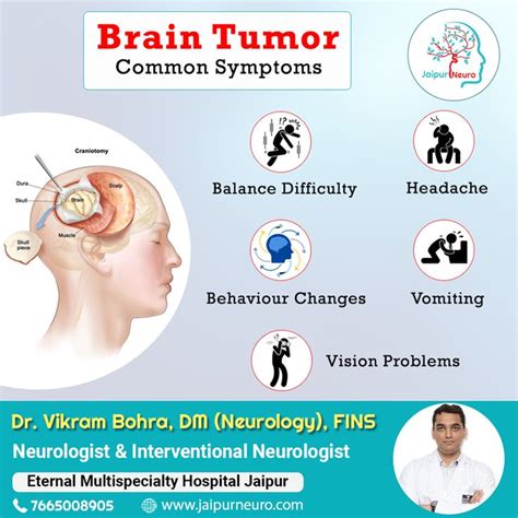 What Are The Signs And Symptoms Of A Brain Tumor