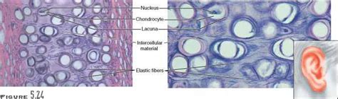 Cartilage Blood Vessels Guws Medical