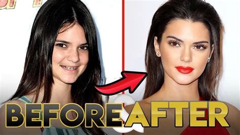 Kendall And Kylie Jenner Then And Now