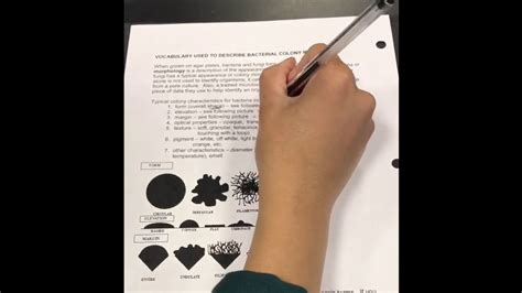 Bacterial Colony Morphology Youtube