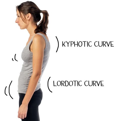 Get Rid Of Sway Back Posture Elevate Physiotherapy