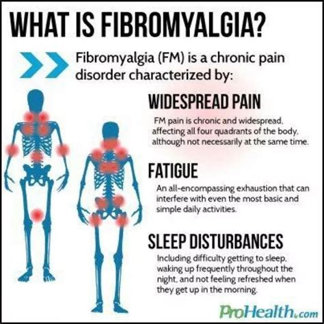 Pin On Migraine Fibromyalgia