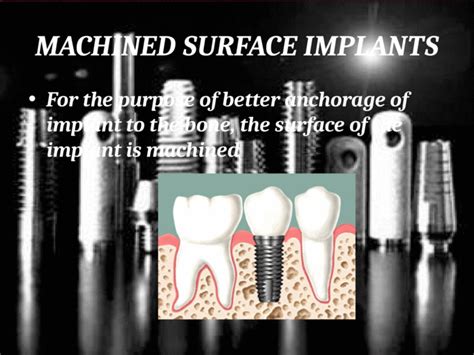 Types And Classification Of Dental Implants Pptx Powerpoint